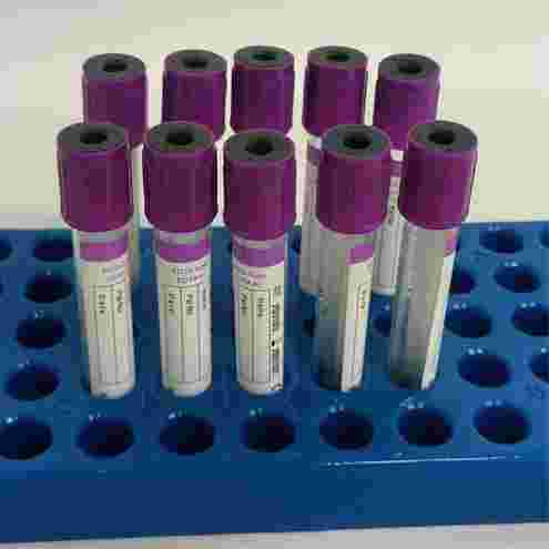 edta tube