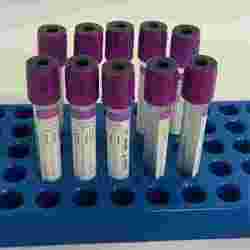 edta tube