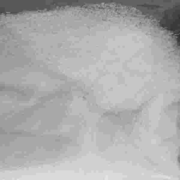 嗎啉丙磺酸鈉鹽