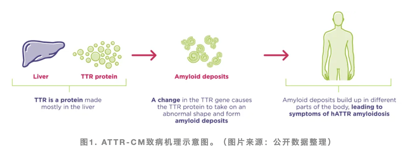圖1. ATTR-CM致病機(jī)理示意圖。（圖片來源：公開數(shù)據(jù)整理）