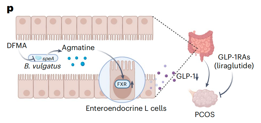 腸道細(xì)菌普通擬桿菌的代謝物胍基丁胺-FXR-GLP-1信號(hào)通路與卵巢功能障礙有關(guān)，這為多囊卵巢綜合征（PCOS）治療提供了一個(gè)潛在靶點(diǎn)