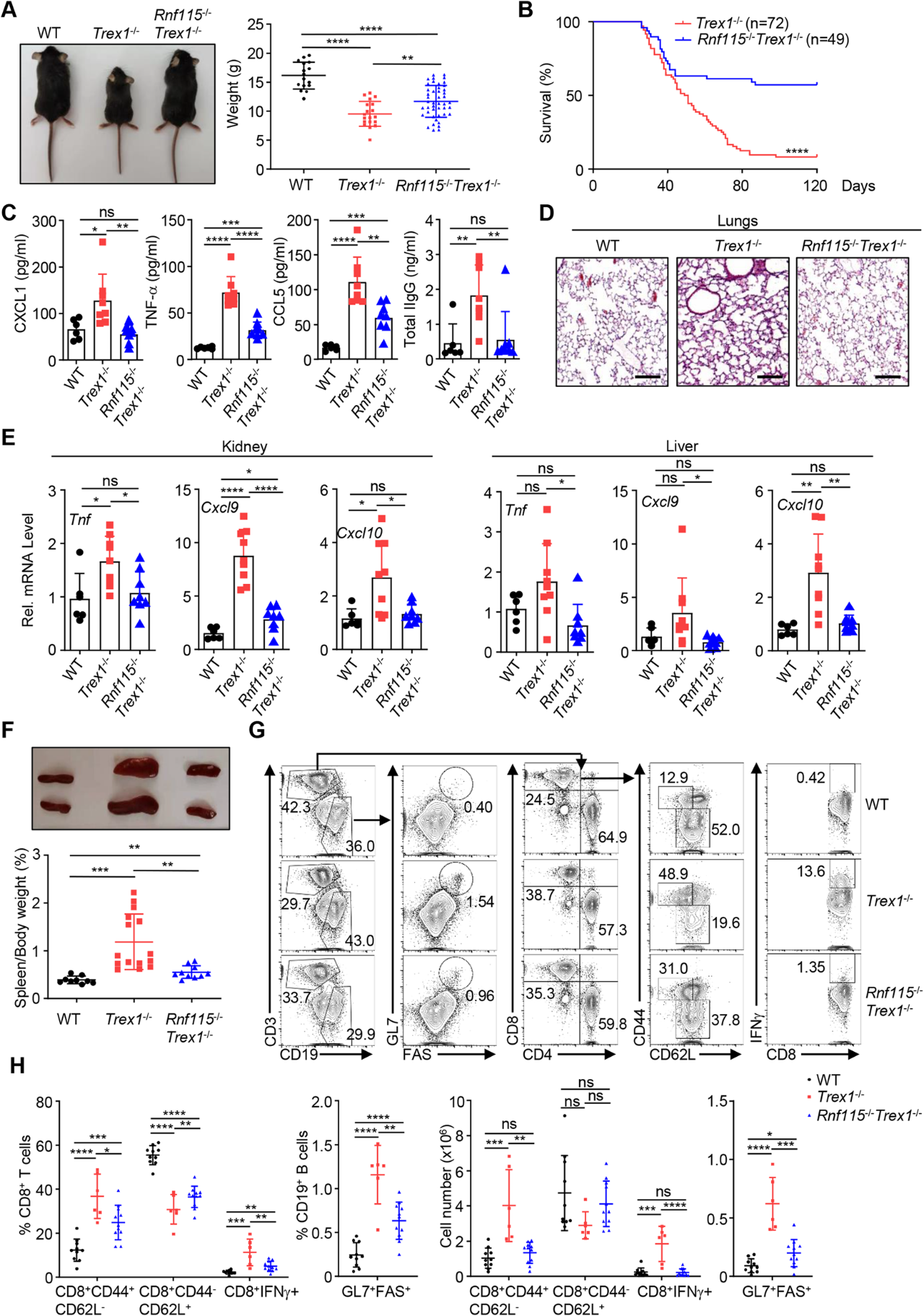 圖1：Deletion of RNF115 attenuates the autoimmune phenotypes of Trex1-/-mice