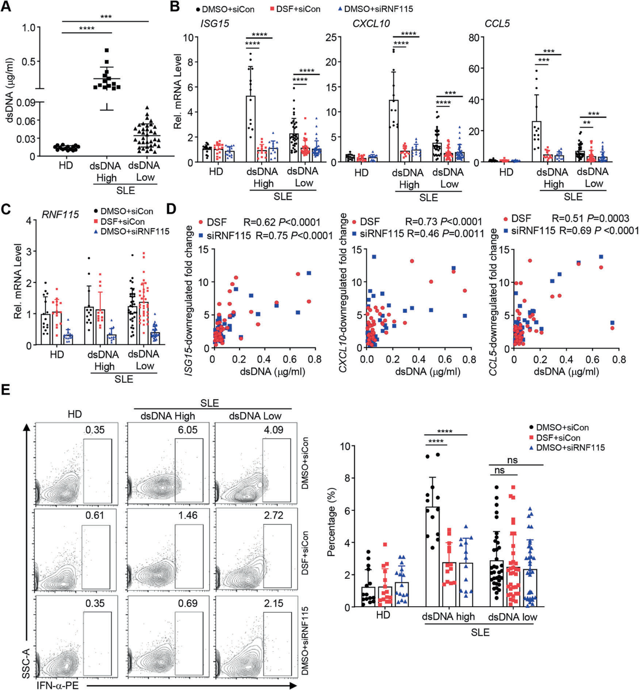 圖2：Inhibition of RNF115 downregulates the expression of proinflammatory cytokines in PBMCs from SLE patients