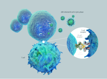 EBV+ PTLD致病機(jī)制