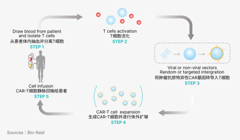 CAR-T治療流程