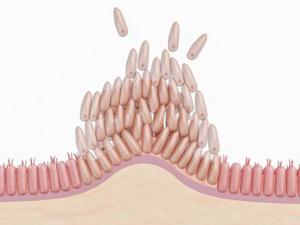 KRAS突變新希望！Avutometinib（VS-6766）與defactinib組合治療KRAS突變復(fù)發(fā)性低級(jí)別漿液性卵巢癌獲FDA授予孤兒藥