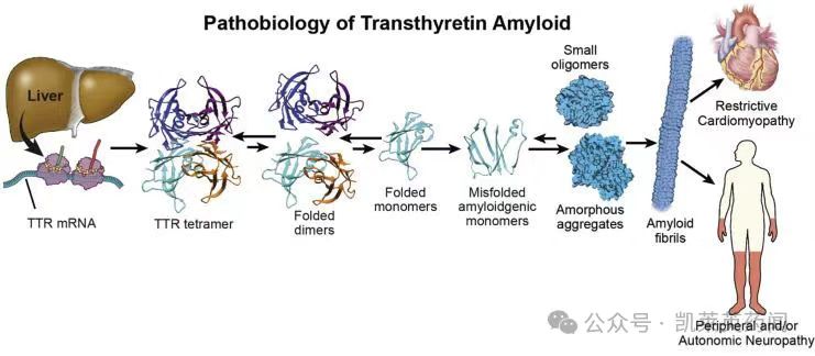 Pathobiology of Transthyretin Amyloid