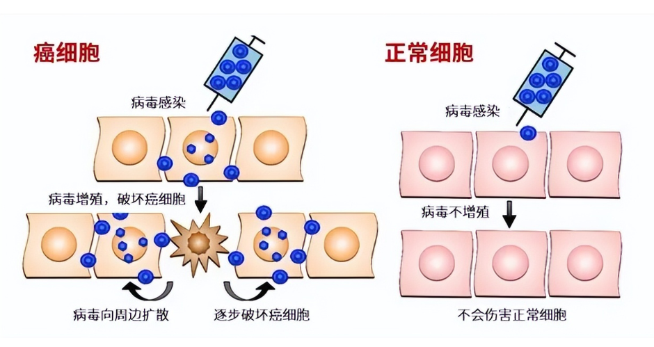 溶瘤病毒機(jī)制