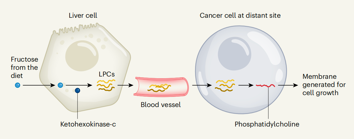 肝臟代謝果糖產(chǎn)生脂質(zhì)促進(jìn)腫瘤生長