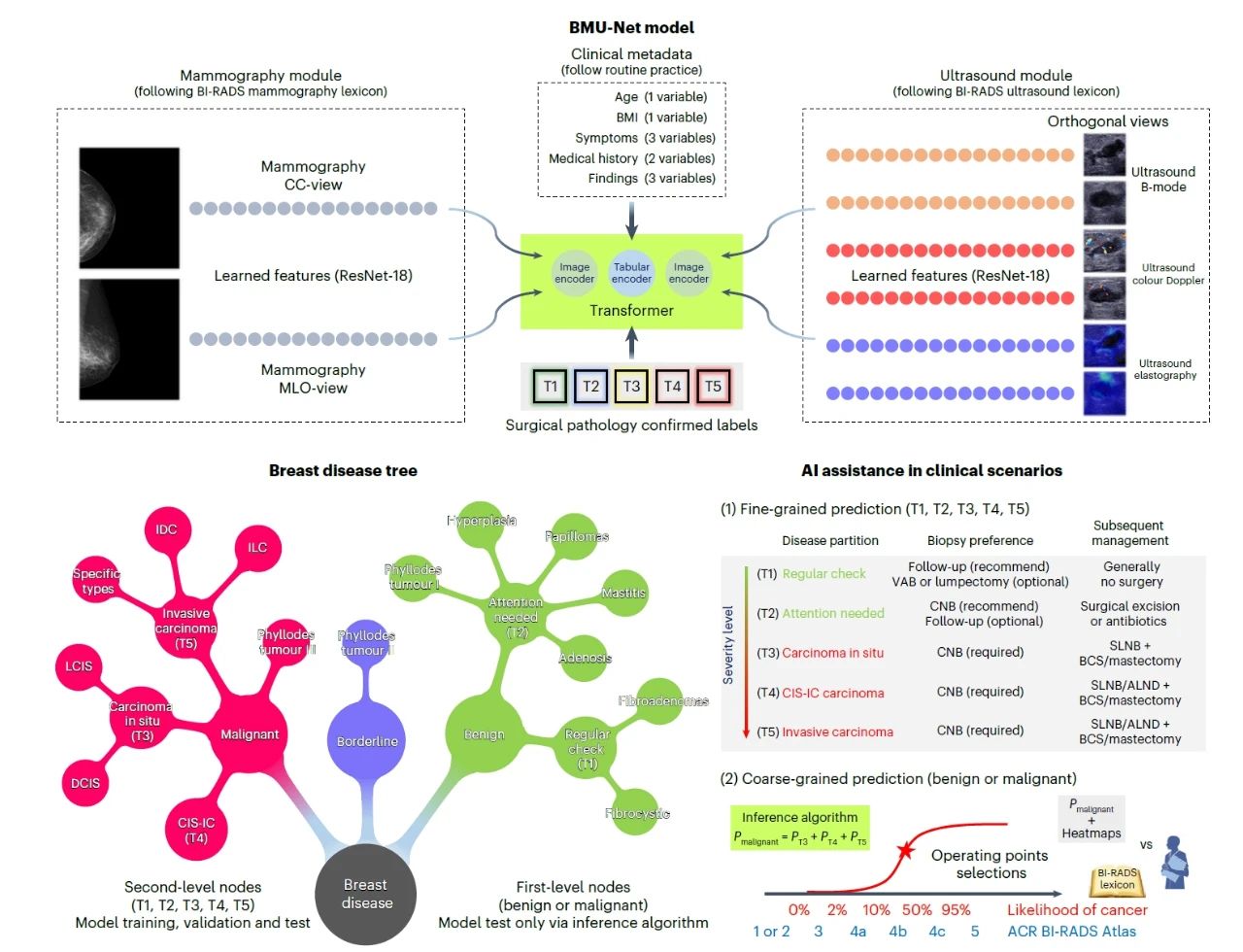 圖1：基于乳腺疾病樹構(gòu)建的BMU-Net模型及多層級乳腺癌風(fēng)險評估策略