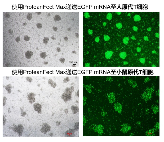 圖1. ProteanFect轉(zhuǎn)染人或小鼠原代T細(xì)胞24小時后的效果檢測