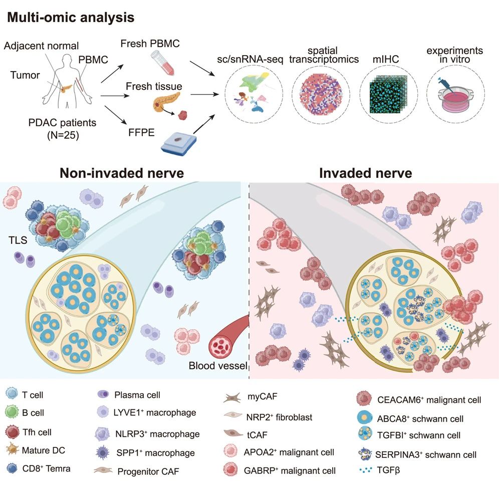 在低神經(jīng)侵犯（low-NI） 腫瘤組織中，三級淋巴結(jié)構(gòu)（tertiary lymphoid structures） 富集并與未受侵犯的神經(jīng)共定位，而在高神經(jīng)侵犯（high-NI） 組織中，NLRP3+ 巨噬細胞和癌癥相關(guān)肌成纖維細胞包圍受侵犯的神經(jīng)。