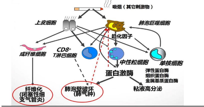 圖：COPD發(fā)病機(jī)制，來源：國信證券