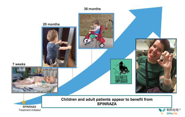 Spinraza已获批用于各个年龄段的SMA患者