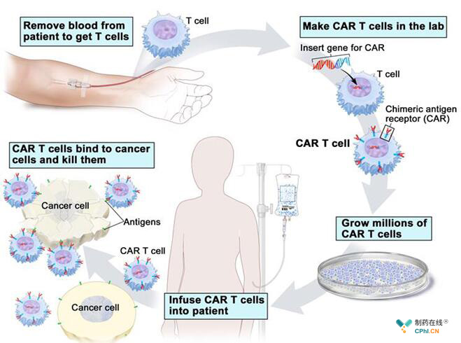 CAR-T细胞治疗过程