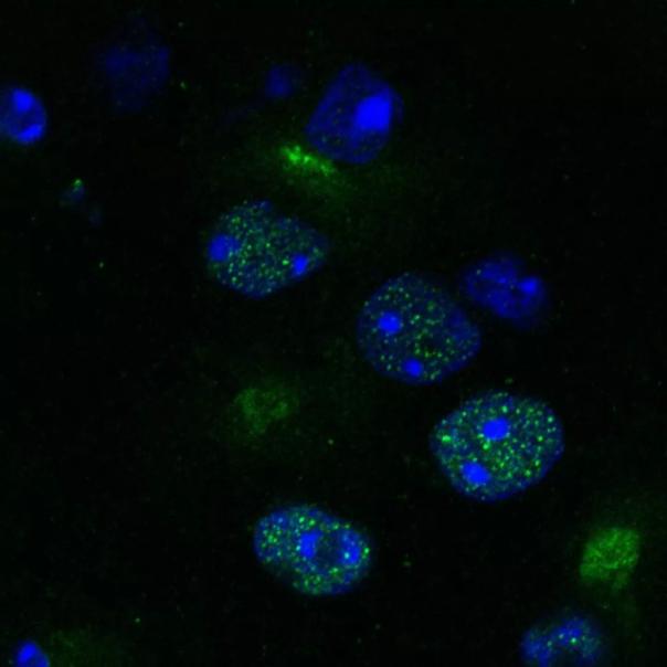 在亨廷顿病的小鼠模型中，疾病相关的亨廷顿蛋白（绿色）有着大量积累