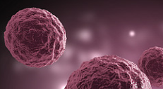 Hebrew University researchers develop a drug for acute leukemia