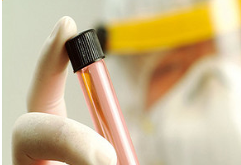 Elpis Biomed human cell models could potentially replace animal experiments in drug discovery