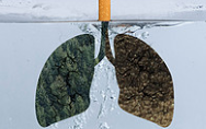 Yuhan licences lung cancer asset to Janssen in $1.25bn deal