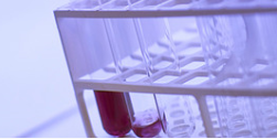 Leukaemia combination therapy effective in Phase II trial