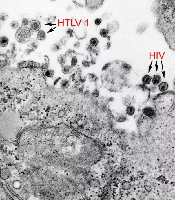电子显微镜下，HTLV与HIV看起来截然不同