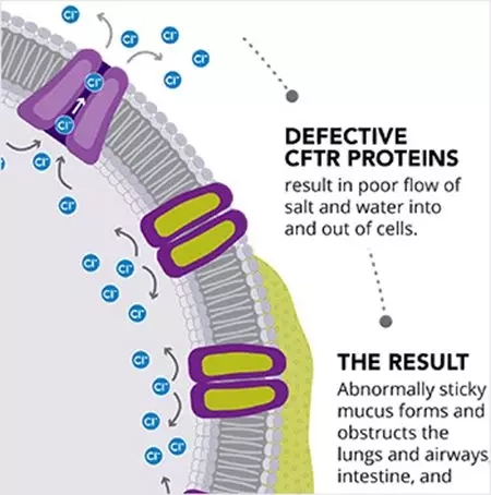 CF由CFTR蛋白功能异常造成
