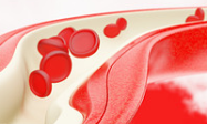 91 percent response rate for venetoclax against newly diagnosed AML in older adults