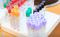 Blood tests could lead to personalised cystic fibrosis treatment