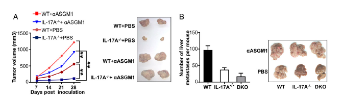 IL-17抑制NK细胞的抗肿瘤活性 图片来源：参考资料[1]