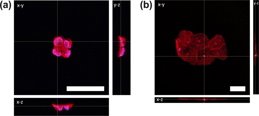 （a）JEG-3和（b）宫颈细胞的共聚焦图像 图片来源：参考资料[2]
