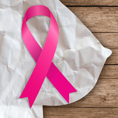 乳腺癌患者淋巴水肿风险