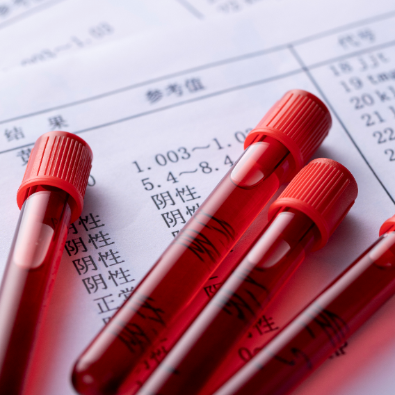 强化生物安全，国家药监局修订血液制品GMP附录