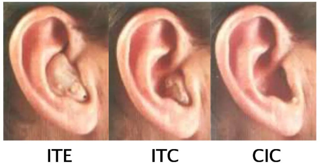 耳内式（ITE）、耳道式（ITC）、完全耳道式（CIC）助听装置