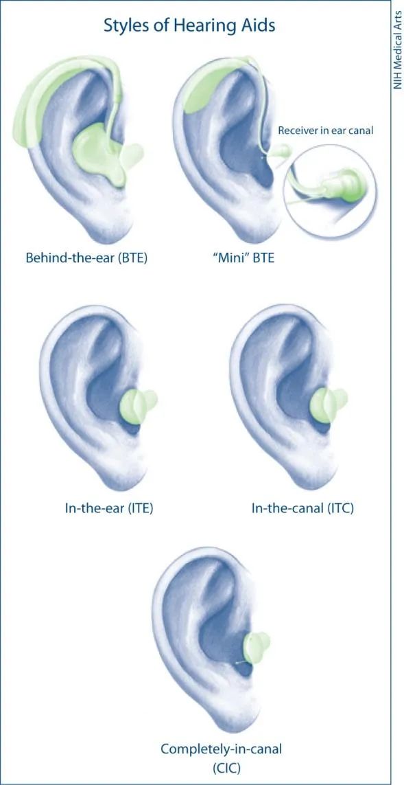 不同类型的助听器