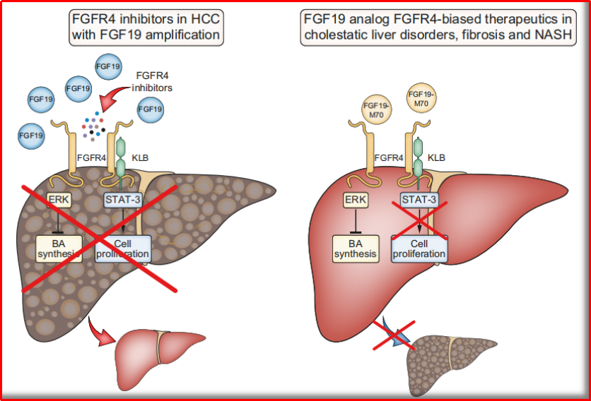 高表达FGF19-FGFR4靶向晚期肝癌