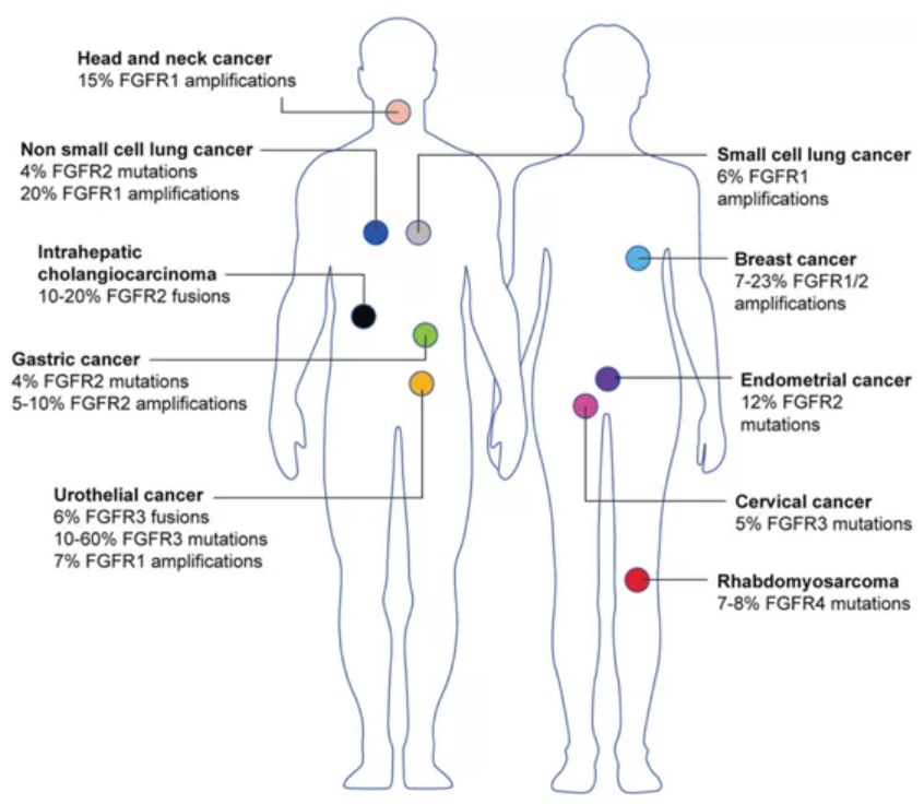 FGFRs发生改变的癌症类型