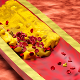 血脂异常治疗新靶点及其药物临床研究进展