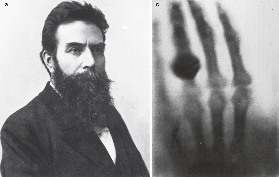 左：伦琴(1845–1923)右：伦琴妻子手部的X光片