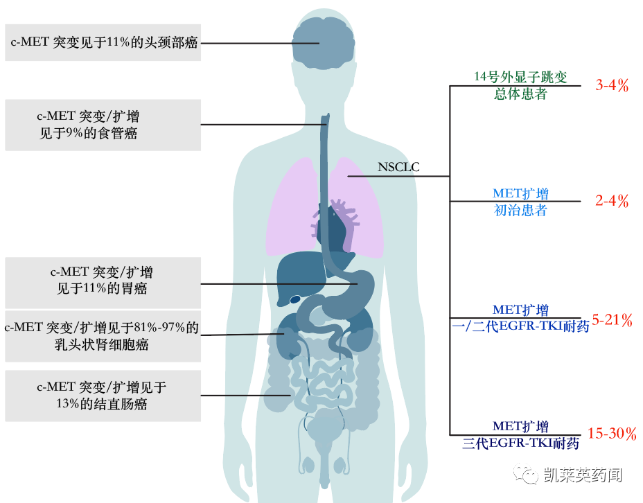 c-Met信号通路在多种类型的实体瘤中均存在异常调节的现象，并且在结直肠癌肝转移，口腔鳞癌的形成、生长、转移，乳腺癌、卵巢癌和胃癌的侵袭、转移，以及肝癌、肺癌和胰腺癌等的发生发展中发挥重要的作用。