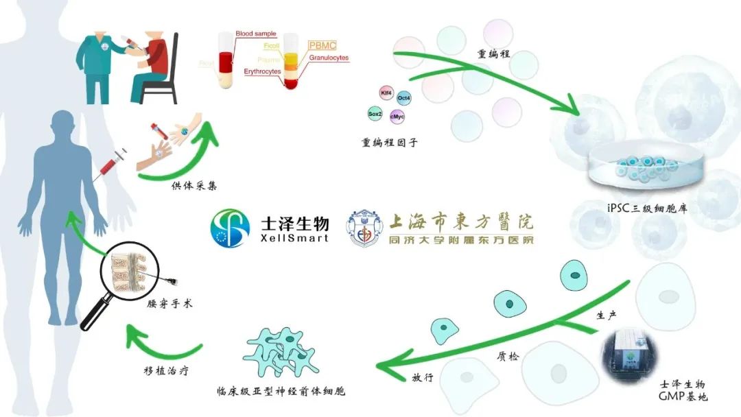 图 | 士泽生物与上海市东方医院临床级iPSC衍生亚型神经前体细胞治疗渐冻症的临床研究启动会正式召开