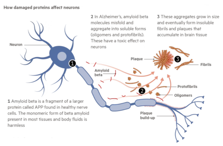 Aβ蛋白对神经元的影响