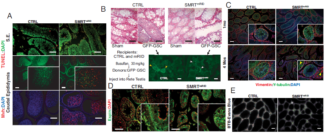 MRTmRID小鼠Sertoli 细胞中分化生殖细胞的丧失和细胞骨架网络缺陷