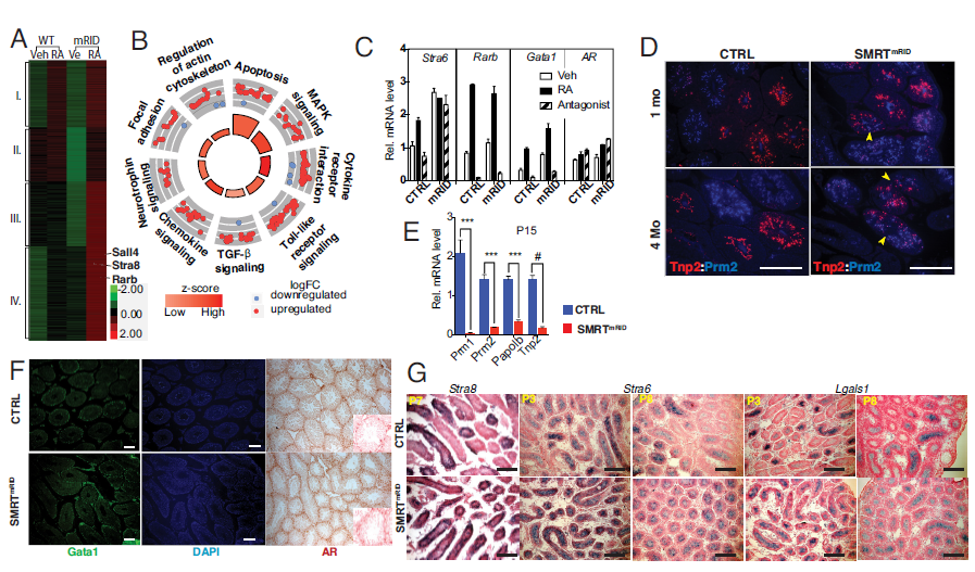 MRTmRID小鼠支持细胞中 RAR 靶基因的去抑制和生精周期的异步进展