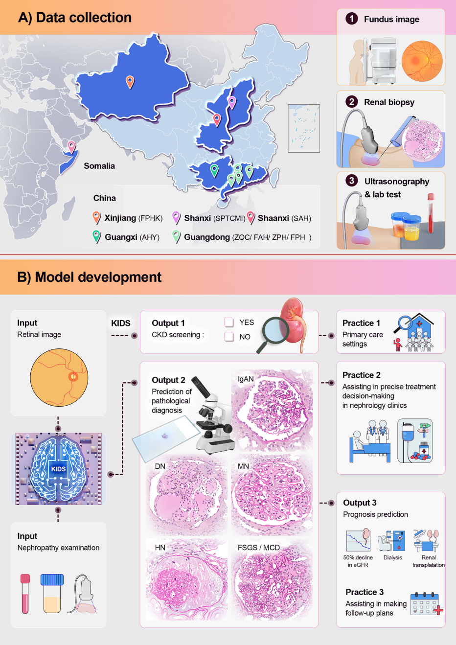 我們開發(fā)了腎臟智能診斷系統(tǒng)（Kidney Intelligent Diagnosis System，KIDS），這是一種利用視網(wǎng)膜圖像或結(jié)合臨床數(shù)據(jù)對慢性腎?。–KD）進(jìn)行早期檢測、病理診斷和長期預(yù)后預(yù)測的非侵入性模型。