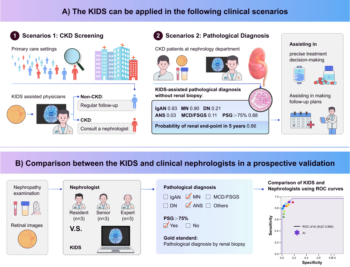將 KIDS 的表現(xiàn)與 12 名腎病專家的病理診斷表現(xiàn)進(jìn)行了比較，KIDS 能夠準(zhǔn)確識別出五種最常見的病理類型（AUC=0.790-0.932），其準(zhǔn)確率比腎病專家高出 26.98%。