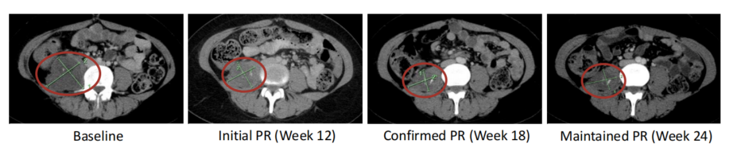 IO創(chuàng)新藥物的長效性和安全性 IO創(chuàng)新藥物的長效性和安全性
