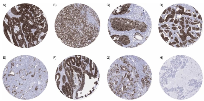 在腸上皮的形成和維持中，CDH17起著重要的作用