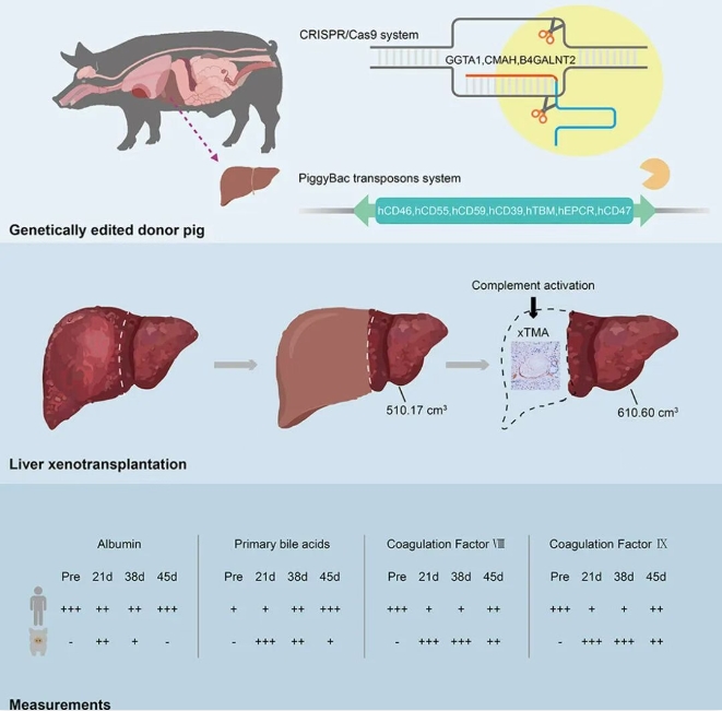 豬肝臟異種移植作為人類輔助肝臟是可行的