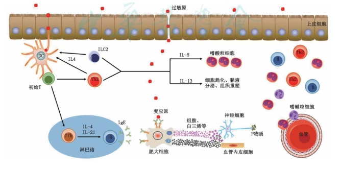 中國變應(yīng)性鼻炎診斷和治療指南 中國變應(yīng)性鼻炎診斷和治療指南