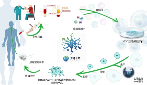 首 例細胞替代性移植治療